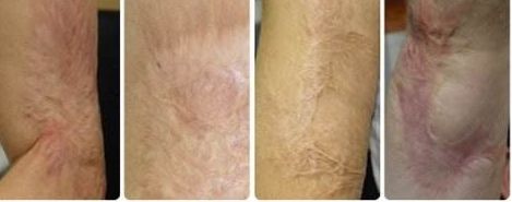 南京去紅血絲醫(yī)院專業(yè)推薦：哪家醫(yī)院技術(shù)高效、費用合理？