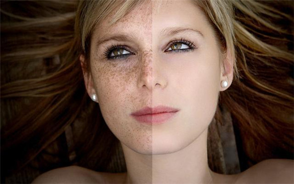 2023河北雙眼皮調(diào)理人氣高的醫(yī)生(崔占琴、盧寧、徐國(guó)建蟬聯(lián)前三甲)