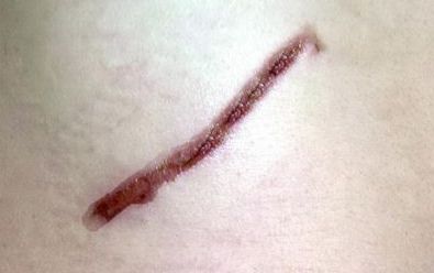 探尋開封市美容醫(yī)院的排名與口碑，哪家值得信賴？