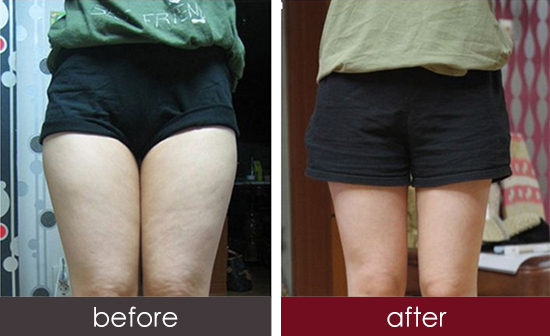 2023湖北淚溝紋填充權(quán)威專家評分前十(邵婕、雷鐵池、雷新明口碑審美雙在線)