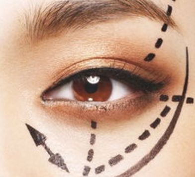 蘭州眼睛美容醫(yī)院哪家好？揭秘蘭州市最受歡迎的眼睛美容醫(yī)院排行榜！