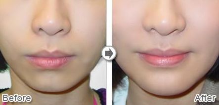 沈陽星美北順城醫(yī)療美容診所怎么樣？沈陽星美北順城醫(yī)療美容診所簡介|醫(yī)生團(tuán)隊|口碑評價！