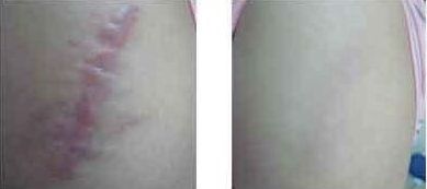 上海割眼袋哪家醫(yī)院靠譜？如何選擇上海割眼袋醫(yī)院？