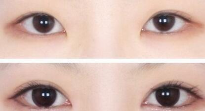 2023重慶唇紋打肉毒素專家綜合實力排行(張貴群、曹勇、孫乘林實力不賴！個人資料一覽~)