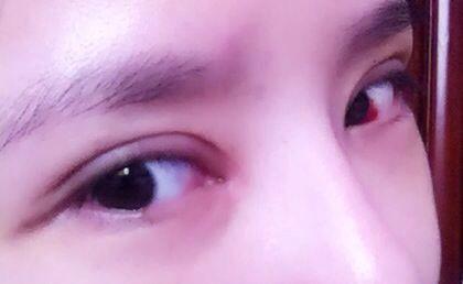 2023重慶做豐唇珠權(quán)威專家上榜前10名(吳偉、薛斌、趙小英反饋超級好)