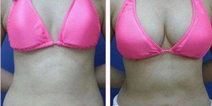 昆明哪家醫(yī)院的光子嫩膚祛斑效果好？