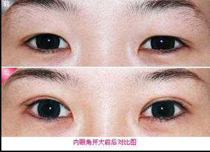 廊坊地區(qū)瘦臉針醫(yī)院排行榜2023：哪家醫(yī)院的瘦臉針效果好？