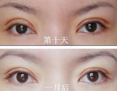 長春哪家醫(yī)院治痘痘好？了解長春市治療青春痘的?？漆t(yī)院及價(jià)格