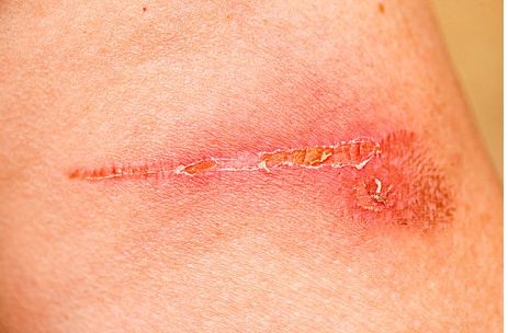 廣州整形醫(yī)院去哪家好？權威排行榜及患者口碑評價對比！