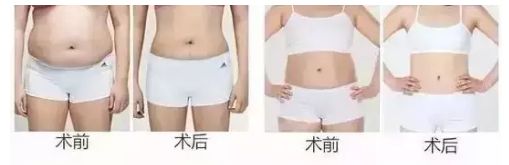 信陽去整形哪家醫(yī)院好？名副其實信陽市最佳整形醫(yī)院TOP推薦