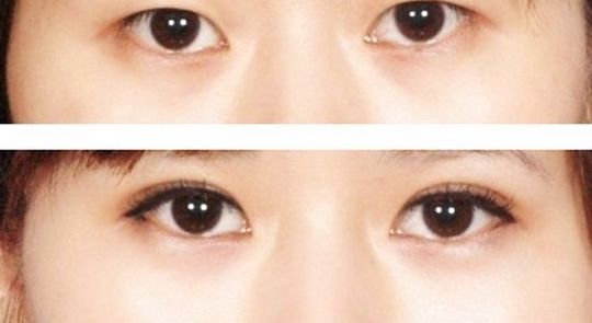 浙江激光祛斑醫(yī)院排名及評(píng)價(jià)，哪家好？