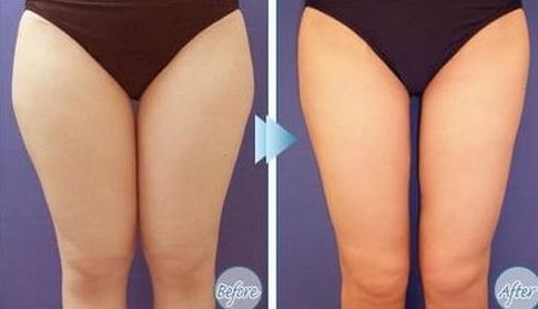 如何選擇最適合您的除腋臭治療醫(yī)院？全國(guó)哪家醫(yī)院好？