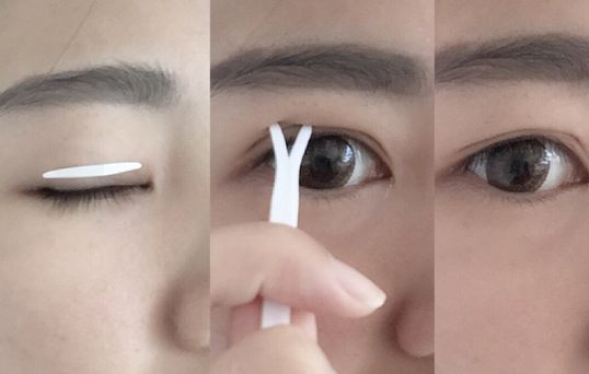 2023寧波除皺紋針評(píng)分前十名醫(yī)生(張利杰、胡繼來、任森洋口碑人氣都可)