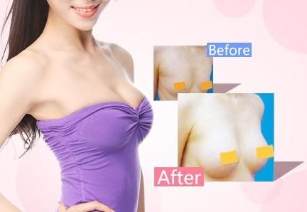 天津哪家醫(yī)院去疤痕好？專業(yè)醫(yī)生推薦的天津去疤痕頂級醫(yī)院有哪些？