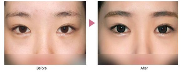 珠海整形醫(yī)院去哪家好？挑選術前評價好的整形醫(yī)院，放心修復您的美麗