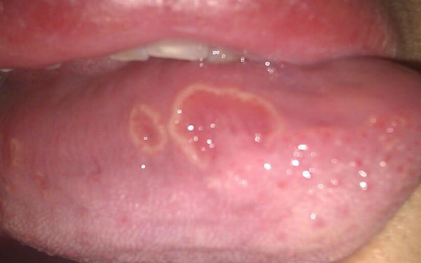 2023洛陽自體脂肪注射眉間紋正規(guī)專家推薦前10名(田會建、林莉、錢紅霞口碑技術點評曝光)