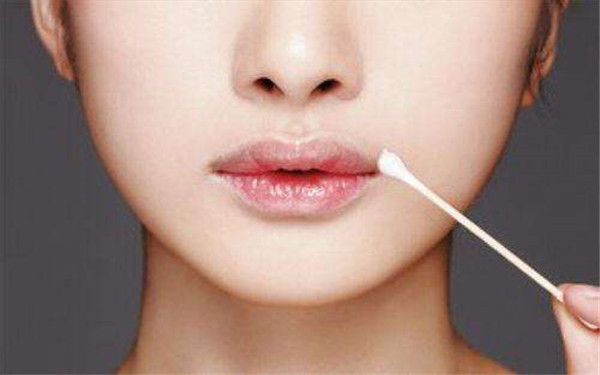 2023廣州除皺針去木偶紋正規(guī)醫(yī)生評分TOP10(楊權明、柳霞、丁莉美知名度很高)