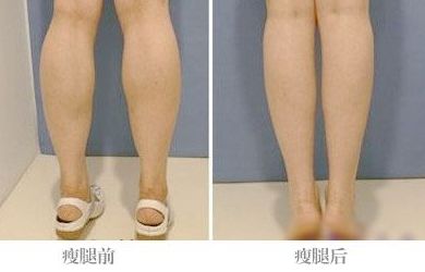 全國激光點(diǎn)痣哪家醫(yī)院好？帶你全面了解最佳選擇！