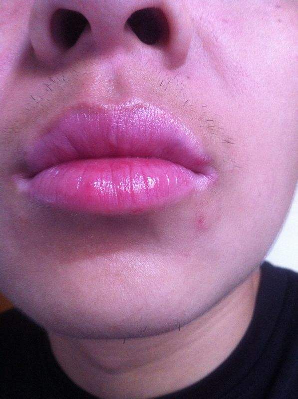 2023南寧玻尿酸面頰除皺榜上前10專家(陳麗娟、凌日龍、邢文明個(gè)個(gè)實(shí)力強(qiáng)橫)