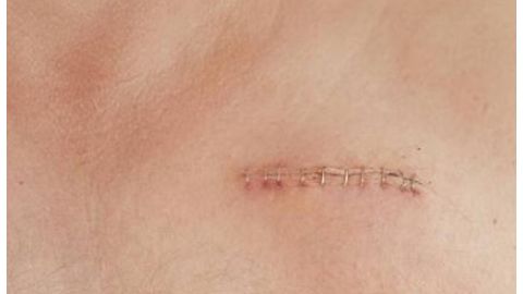 江蘇省中醫(yī)院整形科是否有專(zhuān)業(yè)資質(zhì)？醫(yī)生擅長(zhǎng)哪些項(xiàng)目？簡(jiǎn)介了解一下！