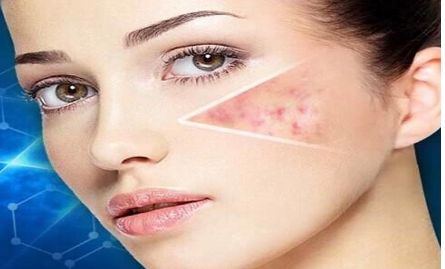 南京哪家醫(yī)院做埋線雙眼皮效果好？