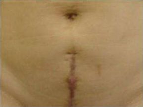 天津祛痘醫(yī)院哪家效果好？為您推薦天津?qū)I(yè)祛痘醫(yī)院排行榜