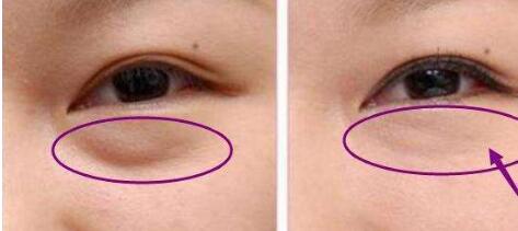 東莞豐胸醫(yī)生名單推薦！權(quán)威醫(yī)師梁如光、鄭志敏等值得信賴