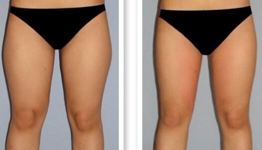 濟南祛痘哪家醫(yī)院技術(shù)好？選擇哪家醫(yī)院更靠譜？