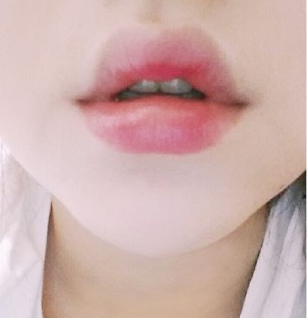 重慶去手術(shù)傷疤哪家醫(yī)院好？探尋重慶專業(yè)治療手術(shù)疤痕的醫(yī)院排名