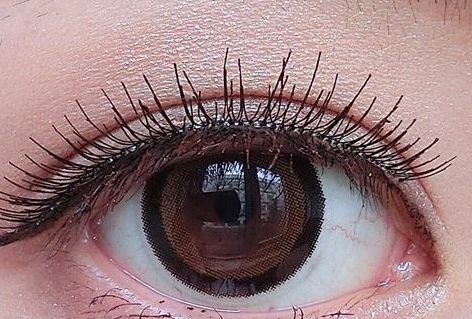 2023武漢鐳射激光祛抬頭紋口碑好的專(zhuān)家(余衛(wèi)平、馬志丹、曾祥蘭口碑實(shí)力印證，值得一覽)