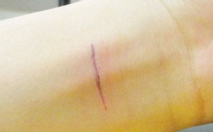 上海哪家隆鼻醫(yī)院好且正規(guī)？優(yōu)質(zhì)咨詢幫助你挑選合適的醫(yī)院