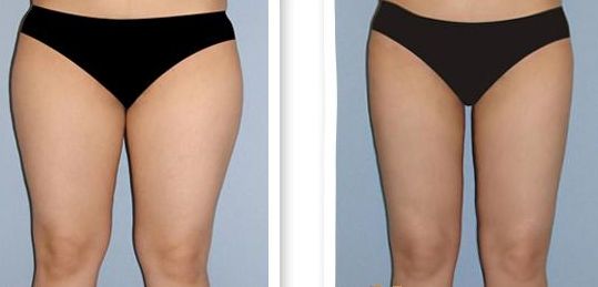 泉州醫(yī)院哪家做手術(shù)好？選泉州醫(yī)院手術(shù)排名榜單