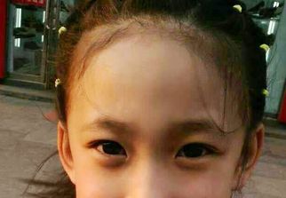 蘇州激光祛疤哪家醫(yī)院好？選擇激光祛疤專家，恢復美肌無憂！