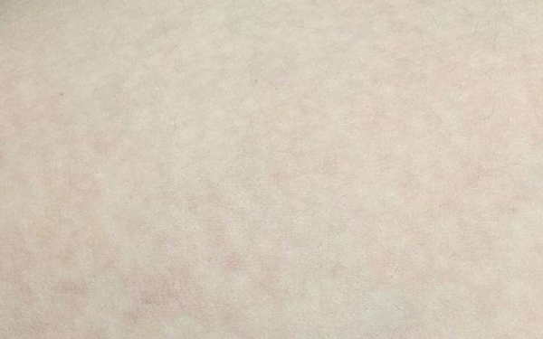 大連哪位醫(yī)生在顴骨整形方面?zhèn)涫懿毮浚筷P(guān)注的5位專家包括關(guān)世超、張東、蔡軍。