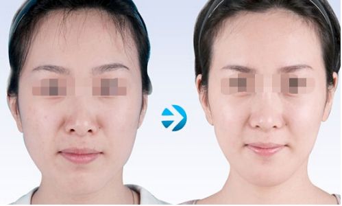 云南雙眼皮手術(shù)有哪些優(yōu)質(zhì)醫(yī)院值得推薦？