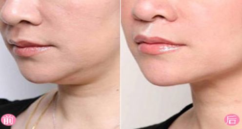 上海去除胎記醫(yī)院排名及口碑評測，哪家醫(yī)院最受用戶好評？