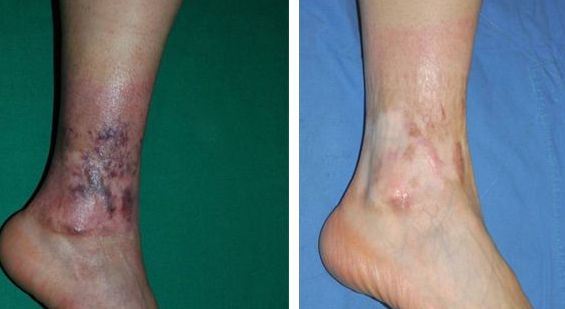 上海手術(shù)點痣醫(yī)院哪家好？揭秘上海最受歡迎的點痣醫(yī)院