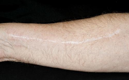 2023青島眼周紋手術(shù)去除醫(yī)生前十位強(qiáng)榜(蔡霞、吳延芳、劉肅資質(zhì)權(quán)威)