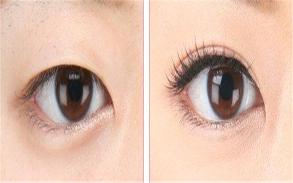 中國(guó)哪家醫(yī)院皮膚修復(fù)好？專家告訴你最靠譜的皮膚修復(fù)醫(yī)院有哪些