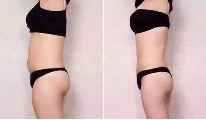 太原哪家醫(yī)院祛痘效果好？專家推薦的太原祛痘醫(yī)院排行榜