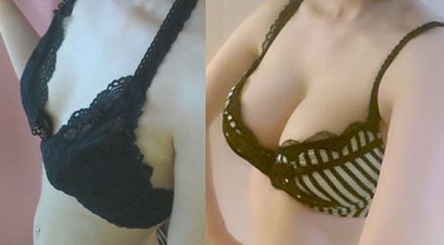 廣州哪家醫(yī)院做微針好？解讀廣州市內(nèi)頂尖微針治療機(jī)構(gòu)