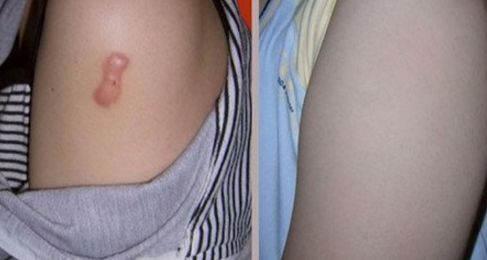 長(zhǎng)沙整形哪家美容醫(yī)院好？專家揭秘長(zhǎng)沙市頂級(jí)整形醫(yī)院排行榜！