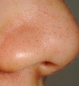 2023重慶填充動態(tài)細紋凹陷排行top10強的醫(yī)生(鄧穎&nbsp;、張代祿、田凱私立醫(yī)美有看頭)