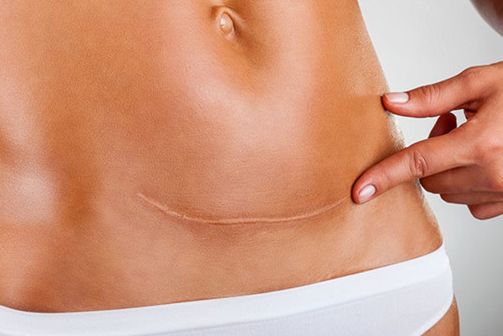 2023西安雙眼皮最佳醫(yī)院排行榜：哪家醫(yī)院的雙眼皮效果好？