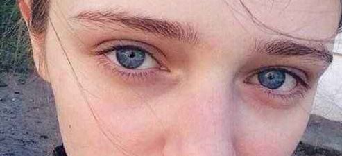 武漢注射豐唇醫(yī)院哪家好？解答最全面的武漢注射豐唇醫(yī)院排名及評(píng)價(jià)