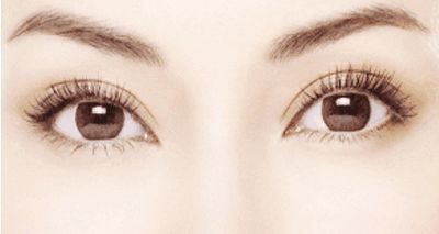 杭州整形哪家好祛眼袋？選擇杭州哪家整形醫(yī)院好祛眼袋效果持久？