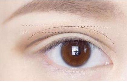 佛山哪家整容醫(yī)院的隆鼻效果出色？