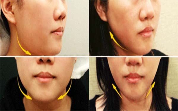 2023烏魯木齊除皺針祛下眼皮皺紋專家前十名(肖春蘭、王寶琳、劉春燕都是實(shí)力派)