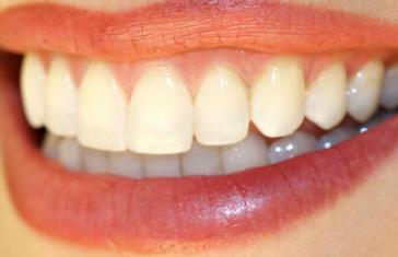 2023杭州去黑頭粉刺精選醫(yī)生(李亞梅、沈海燕、劉楊值得信賴)