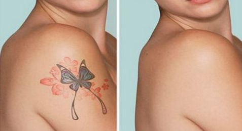 昆明燒傷疤痕消除專家推薦：百家醫(yī)院評選全指南